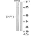 Western blot analysis of extracts from HuvEc cells, using TNF11 antibody.