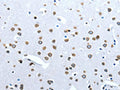 The image on the left is immunohistochemistry of paraffin-embedded Human brain tissue using CSB-PA111496(ACE2 Antibody) at dilution 1/30, on the right is treated with fusion protein. (Original magnification: ×200)