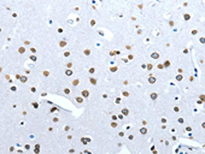 The image on the left is immunohistochemistry of paraffin-embedded Human brain tissue using CSB-PA111496(ACE2 Antibody) at dilution 1/30, on the right is treated with fusion protein. (Original magnification: ×200)