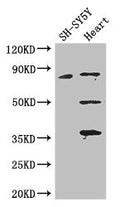 Western Blot
Positive WB detected in: SH-SY5Y whole cell lysate, Mouse heart tissue
All lanes: MAPT antibody at 3.25ug/ml
Secondary
Goat polyclonal to rabbit IgG at 1/50000 dilution
Predicted band size: 79, 37, 33, 40, 43, 41, 46, 81 kDa
Observed band size: 79, 50, 36 kDa