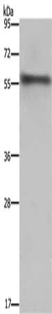 Gel: 8%SDS-PAGE, Lysate: 40 ug, Lane: Mouse heart tissue, Primary antibody: CSB-PA112026(FKBP8 Antibody) at dilution 1/1000, Secondary antibody: Goat anti rabbit IgG at 1/8000 dilution, Exposure time: 1 minute