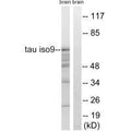 Western blot analysis of extracts from rat brain cells, using Tau (Ab-717/400) antibody.