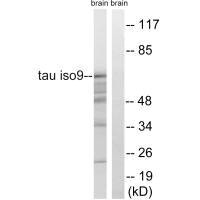 Western blot analysis of extracts from rat brain cells, using Tau (Ab-717/400) antibody.