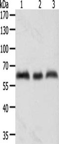Gel: 10%SDS-PAGE, Lysate: 50 ug, Lane 1-3: A375 cells, Hela cells, Jurkat cells, Primary antibody: CSB-PA112776(TYR Antibody) at dilution 1/600, Secondary antibody: Goat anti rabbit IgG at 1/8000 dilution, Exposure time: 3 minutes