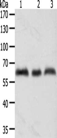 Gel: 10%SDS-PAGE, Lysate: 50 ug, Lane 1-3: A375 cells, Hela cells, Jurkat cells, Primary antibody: CSB-PA112776(TYR Antibody) at dilution 1/600, Secondary antibody: Goat anti rabbit IgG at 1/8000 dilution, Exposure time: 3 minutes