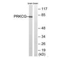 Western blot analysis of extracts from Rat brain cells, using PRKCG(Ab-655) antibody.