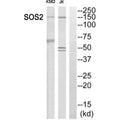 Western blot analysis of extracts from K562 cells and Jurkat cells, using SOS2 antibody.