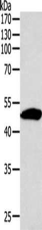 Gel: 10%SDS-PAGE, Lysate: 40 ug, Lane: Mouse thymus tissue, Primary antibody: CSB-PA113703(SIRT6 Antibody) at dilution 1/350, Secondary antibody: Goat anti rabbit IgG at 1/8000 dilution, Exposure time: 1 minute