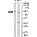 Western blot analysis of extracts from Jurkat cells and HepG2 cells, using MIC1 antibody.
