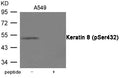 Western blot analysis of extracts from A549 cells using Keratin 8 (Phospho-Ser432) Antibody.The lane on the right is treated with the antigen-specific peptide.