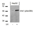 Western blot analysis of extracts from HepG2 cells untreated or treated with UV using Chk1(Phospho-Ser280) Antibody.