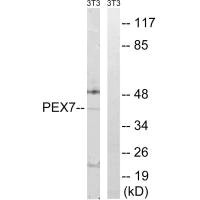 Western blot analysis of extracts from NIH/3T3 cells, using PEX7 antibody.
