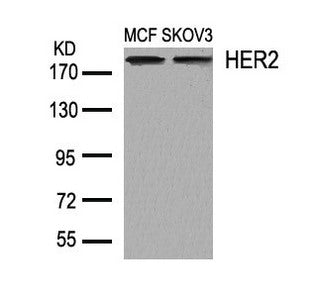 Western blot analysis of extracts from MCF and SKOV3 cells using HER2(Ab-1248) Antibody.