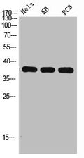 Western Blot analysis of HELA KB PC-3 using p38 Polyclonal Antibody. Antibody was diluted at 1:1000. Secondary antibody  was diluted at 1:20000