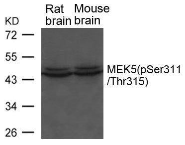 Western blot analysis of extracts from Rat and Mouse brain tissue using MEK5(phospho-Ser311/ Thr315) Antibody.