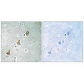Immunohistochemistry analysis of paraffin-embedded human brain tissue using PECAM-1 (Ab-713) antibody.