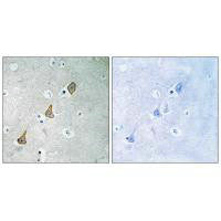 Immunohistochemistry analysis of paraffin-embedded human brain tissue using PECAM-1 (Ab-713) antibody.