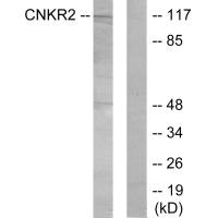 Western blot analysis of extracts from Jurkat cells, using CNKR2 antibody.