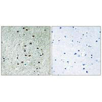 Immunohistochemistry analysis of paraffin-embedded human brain tissue using REXO1 antibody.