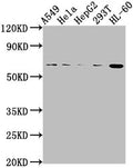 MDM2 Antibody – Figure 1 of 2
