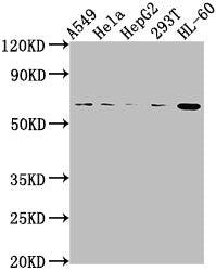 MDM2 Antibody – Figure 1 of 2