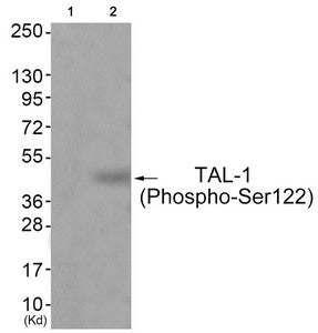 Western blot analysis of extracts from JK cells (Lane 2), using TAL-1 (Phospho-Ser122) Antibody. The lane on the left is treated with antigen-specific peptide.