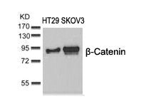 Western blot analysis of extracts from HT29 and SKOV3 cells using b-Catenin(Ab-37) Antibody.