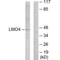 Western blot analysis of extracts from 293 cells, using LMO4 antibody.