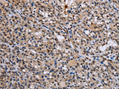 GADD45A Antibody – Figure 1 of 1