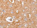 The image on the left is immunohistochemistry of paraffin-embedded Human brain tissue using CSB-PA119606(IGSF8 Antibody) at dilution 1/15, on the right is treated with fusion protein. (Original magnification: ×200)