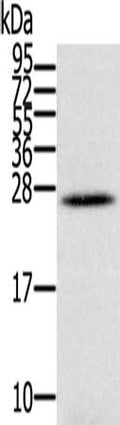 Gel: 12%SDS-PAGE, Lysate: 40 ug, Lane: Human ovarian cancer tissue, Primary antibody: CSB-PA119801(IFNL3 Antibody) at dilution 1/350, Secondary antibody: Goat anti rabbit IgG at 1/8000 dilution, Exposure time: 1 minute