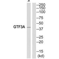 Western blot analysis of extracts from Jurkat cells, using GTF3A antibody.