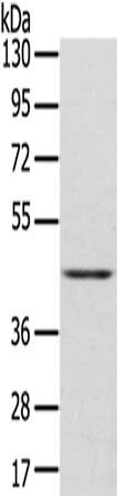 Gel: 6%SDS-PAGE, Lysate: 40 ug, Lane: Hepg2 cells, Primary antibody: CSB-PA120648(DLK1 Antibody) at dilution 1/200, Secondary antibody: Goat anti rabbit IgG at 1/8000 dilution, Exposure time: 3 minutes
