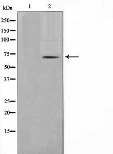 Western blot analysis on NIH-3T3 cell lysate using TGFR2 Antibody