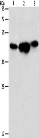 Gel: 10%SDS-PAGE, Lysate: 40 ug, Lane 1-3: 293T cells, PC3 cells, NIH/3T3 cells, Primary antibody: CSB-PA122169(ARFGAP1 Antibody) at dilution 1/850, Secondary antibody: Goat anti rabbit IgG at 1/8000 dilution, Exposure time: 10 seconds