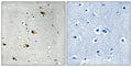 Immunohistochemical analysis of paraffin-embedded human brain tissue using E2A (Phospho-Thr355) antibody (left)or the same antibody preincubated with blocking peptide (right).