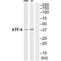 Western blot analysis of extracts from A549 cells and Jurkat cells, using ATF-4 (Ab-219) antibody.