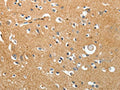 The image on the left is immunohistochemistry of paraffin-embedded Human brain tissue using CSB-PA123979(AKAP12 Antibody) at dilution 1/40, on the right is treated with synthetic peptide. (Original magnification: ×200)