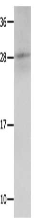 Gel: 12%SDS-PAGE, Lysate: 30 ug, Lane: Mouse kidney tissue, Primary antibody: CSB-PA124101(KLK15 Antibody) at dilution 1/300, Secondary antibody: Goat anti rabbit IgG at 1/8000 dilution, Exposure time: 10 seconds