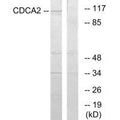 Western blot analysis of extracts from 293 cells, using CDCA2 antibody.