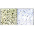 Immunohistochemistry analysis of paraffin-embedded human prostate carcinoma tissue, using RHG07 antibody.