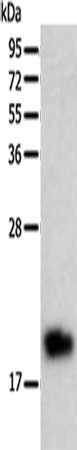 Gel: 12%SDS-PAGE, Lysate: 40 ug, Lane: Human liver cancer tissue, Primary antibody: CSB-PA124546(BTG2 Antibody) at dilution 1/200, Secondary antibody: Goat anti rabbit IgG at 1/8000 dilution, Exposure time: 10 minutes