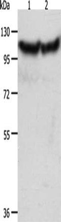Gel: 10%SDS-PAGE, Lysate: 40 ug, Lane 1-2: Hela cells, NIH/3T3 cells, Primary antibody: CSB-PA124802(ACTN3 Antibody) at dilution 1/300, Secondary antibody: Goat anti rabbit IgG at 1/8000 dilution, Exposure time: 10 seconds