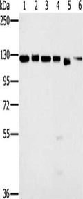 Gel: 6%SDS-PAGE, Lysate: 40 ug, Lane 1-6: 293T cells, K562 cells, hela cells, 231 cells, Jurkat cells, NIH/3T3 cells, Primary antibody: CSB-PA125471(MATR3 Antibody) at dilution 1/500, Secondary antibody: Goat anti rabbit IgG at 1/8000 dilution, Exposure time: 3 seconds
