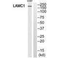 Western blot analysis of extracts from HUVEC cells, using MSH6 antibody.