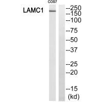 Western blot analysis of extracts from HUVEC cells, using MSH6 antibody.