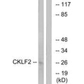 Western blot analysis of extracts from K562 cells, using CKLF2 antibody.