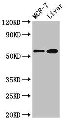 Western Blot
Positive WB detected in: MCF-7 whole cell lysate, Mouse liver tissue
All lanes: CBS antibody at 2.7µg/ml
Secondary
Goat polyclonal to rabbit IgG at 1/50000 dilution
Predicted band size: 61, 62 kDa
Observed band size: 61 kDa