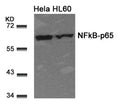 Western blot analysis of extracts from Hela and HL60 cells using NFkB-p65(Ab-311) Antibody.