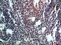 Immunohistochemical analysis of paraffin-embedded Human-tonsil, antibody was diluted at 1:100